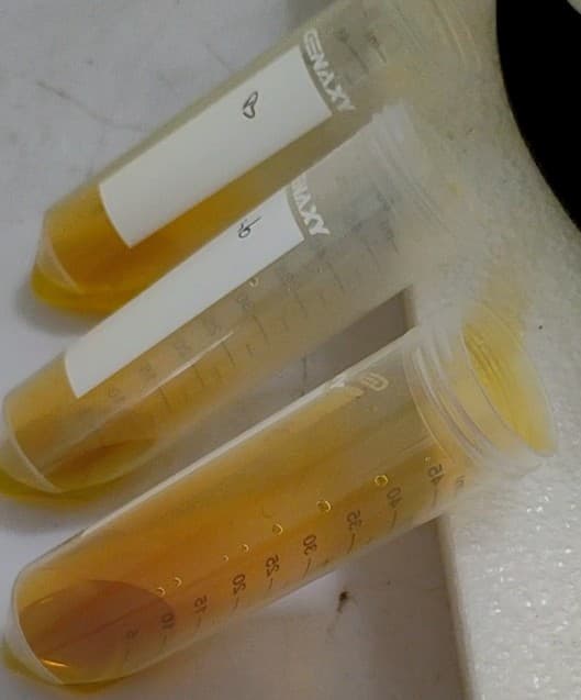 Water Circularity and Environmental Health Image 2